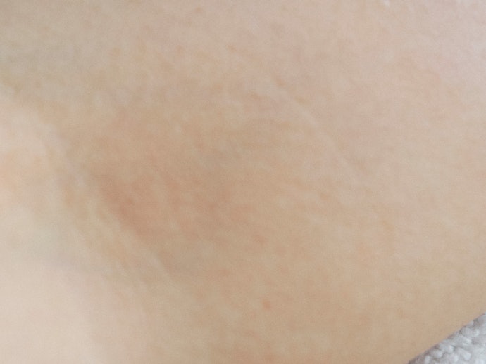 Hầu Hết Kem Trôi Đi Nếu Bị Ma Sát Quá Mạnh!