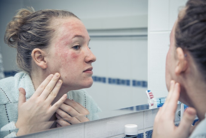 Tác Dụng Phụ Khi Dùng Tretinoin